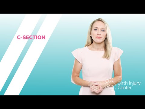 C section Complications | Birth Injuries