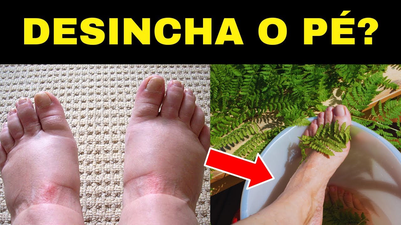 Isso acontece quando você come essas ervas todos os dias.