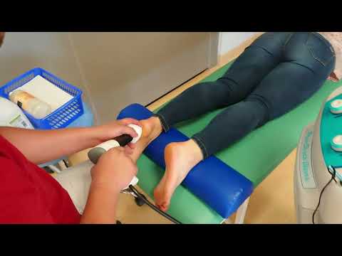 Centrum Medyczne BetaMed - zabieg falą uderzeniową w leczeniu ostrogi piętowej