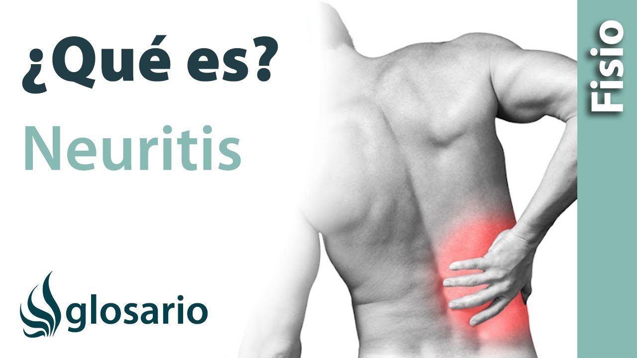 NEURITIS | Qué es, qué afecta, síntomas, signos clínicos, causas y tratamiento fisioterapéutico