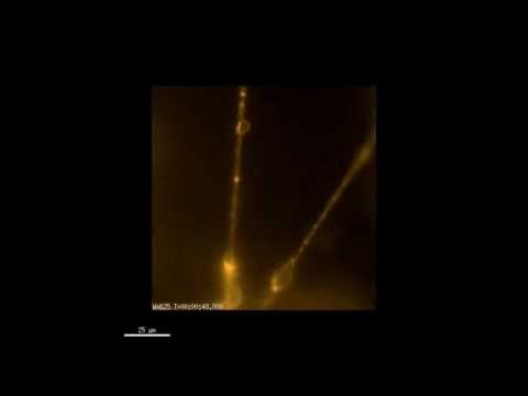 Scientific Reports : Generation of retinal ganglion cells with functional axons from human...