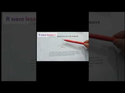 R wave in detail #doctor #ultrasoundtechnologist #informational #ultrasoundtech #clinical #science