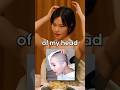 Going Bald