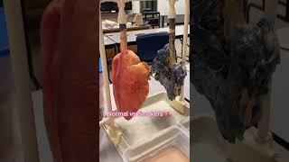 Download lagu Beginilah perbedaan paru-paru orang normal dan perokok. Sumber video: Haya mp3 Download lagu Beginilah perbedaan paru-paru orang normal dan perokok. Sumber video: Haya mp3