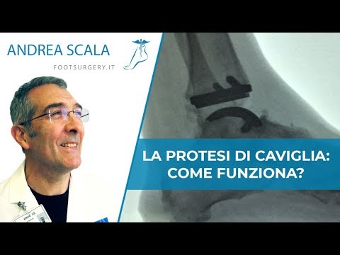 Sanguinamento nelle articolazioni Sintomi dellanca reumatismi