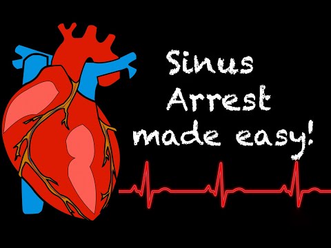 EMS Cardiology || Tachy Tuesday: Sinus Arrest in EMS
