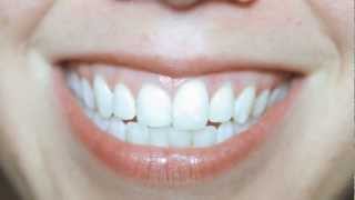 LANDLADY- &#39;Above My Ground&#39; (Official Human Music Video)