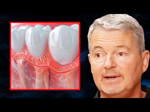Can You ACTUALLY Regrow Receding Gums? | Dr. Mark Burhenne