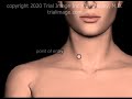 Internal Jugular Vein (IJV) Access Normovolemic Patient Animation by Cal Shipley, M.D.