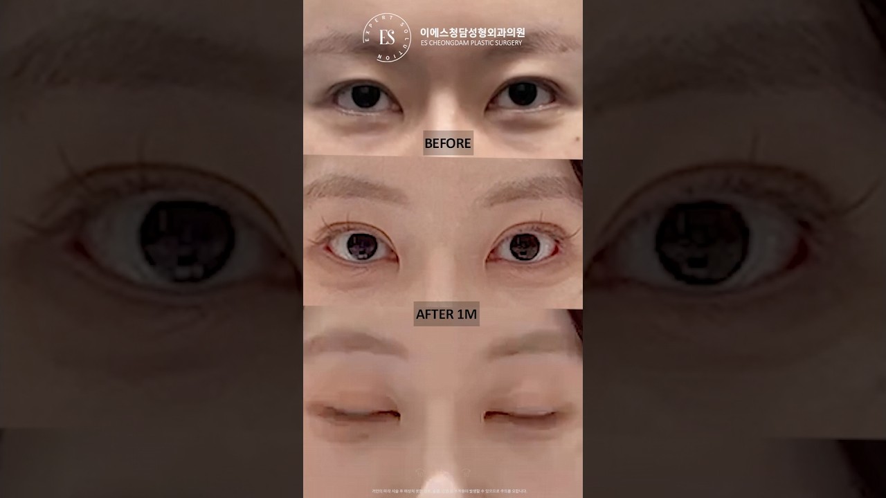 이에스 유튜브