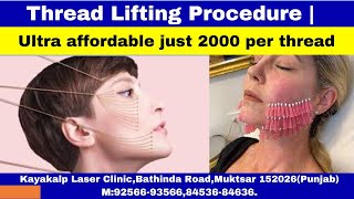 Download Lagu Thread Lifting Procedure | Ultra affordable just 2000 per thread Thumbnail