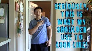 Correcting Common Posture Deviations Shoulder Elevation