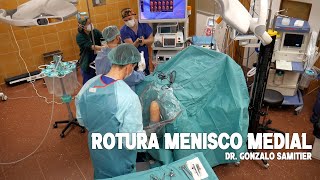 ROTURA MENISCO MEDIAL DEGENERATIVA