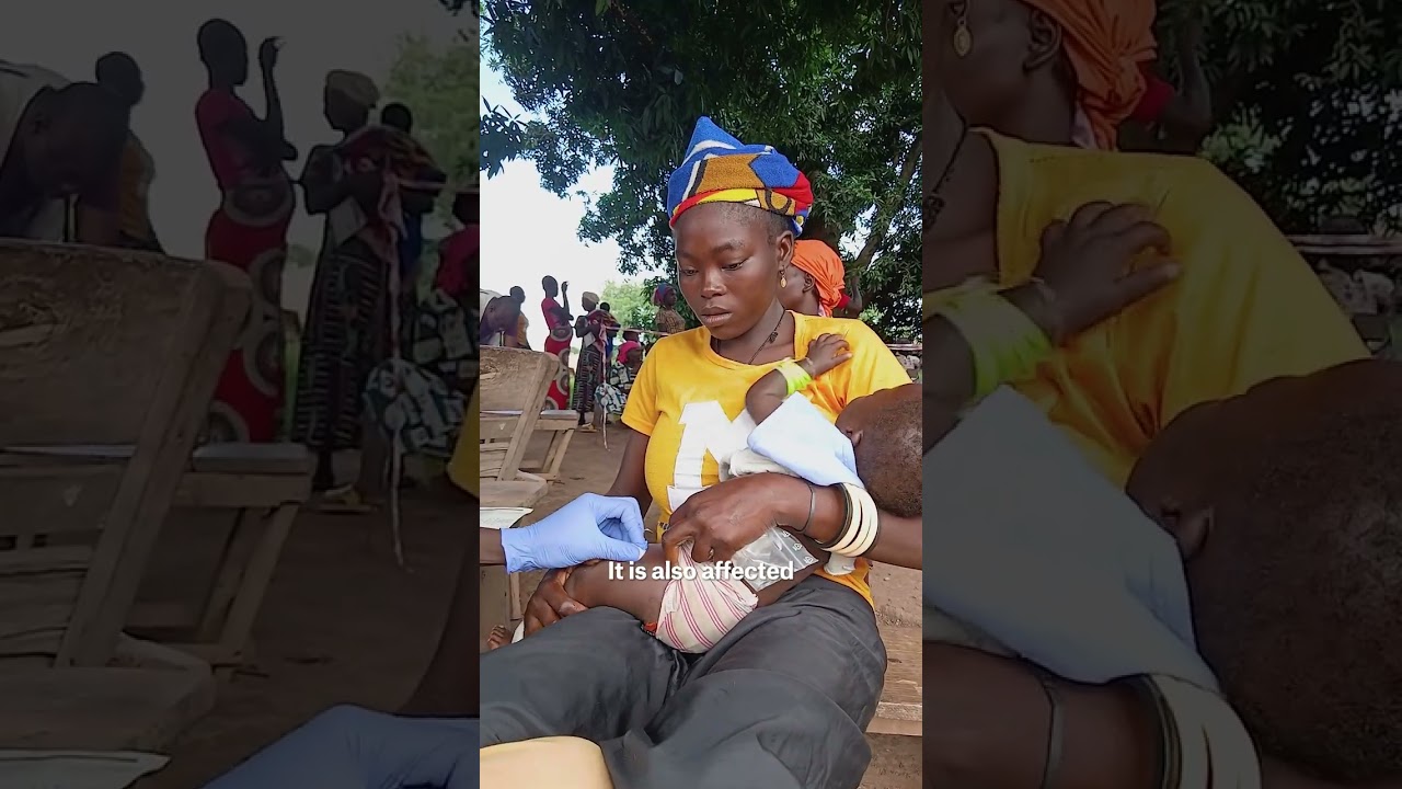 EURECA: MSF mobile team responds to emergencies in the Central African Republic