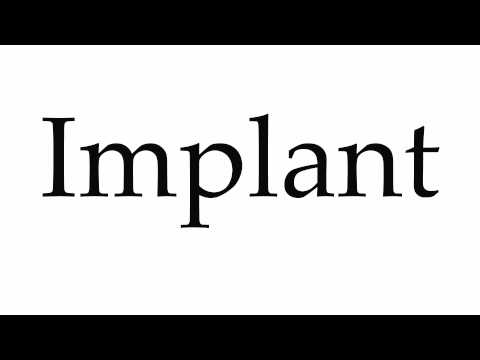 How to Pronounce Implant
