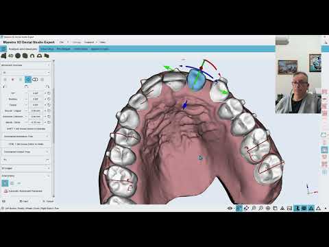 In-house Aligners and DIY solutions - Part 6