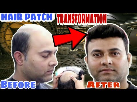 Hair Patch That Look Real Mens Hair Wig. | Hair Transformation | How to