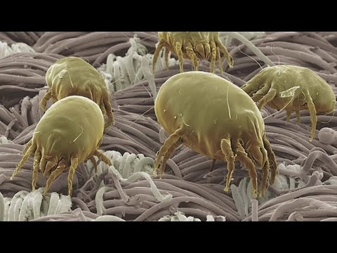 Good Question: What Are Dust Mites?