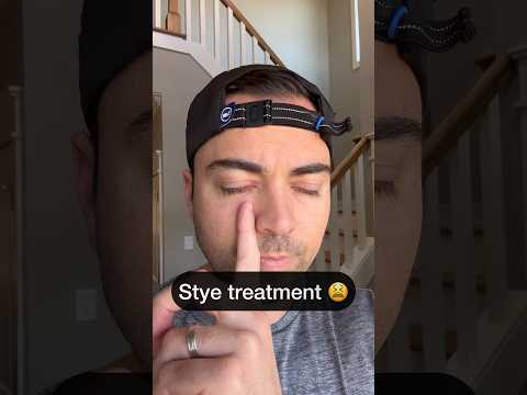 Optometrist gets a stye 👀