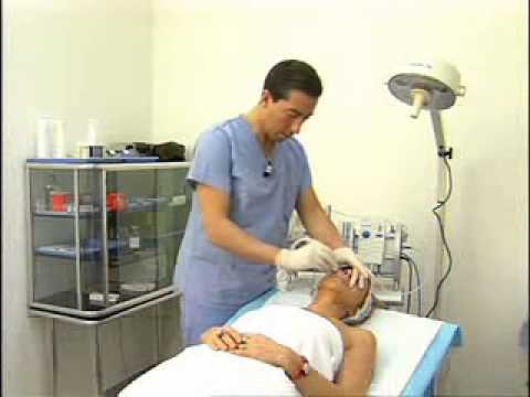 Microdermabrasion Video  Eng