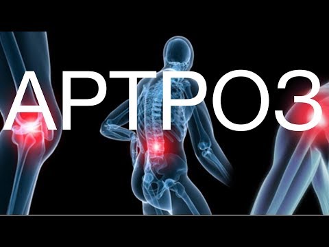 Osteopatico nel trattamento di ernia intervertebrale Di dormire sulla pancia fa male lombo