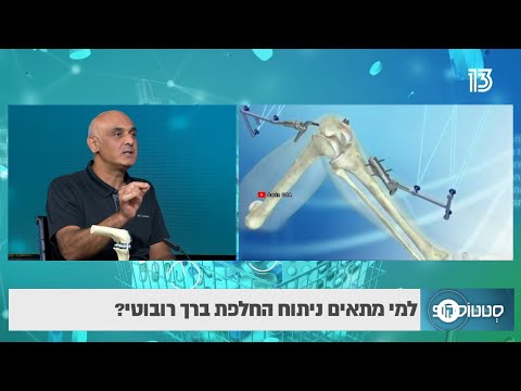 החלפת ברך: מה ההבדל בין ניתוח רגיל לניתוח החלפת ברך רובוטי- סטטוסקופ