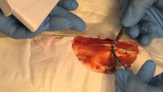 How To Staple Skin with Dr. Bones