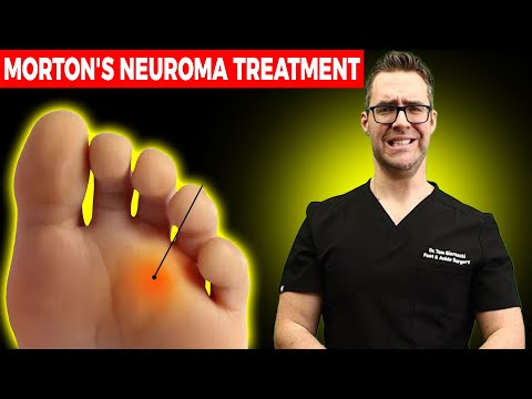 , title : '11 BEST Mortons Neuroma Massage, Exercise & Stretch Treatments [WOW!]'