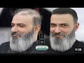 Hair Patch Men Ulhasnagar Hair Replacement Men Dombivali 9075156688