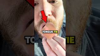 Is The Tongue Tie ACTUALLY Useful?😳😱