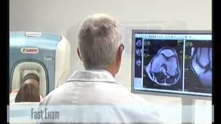 O-scan MRI exam kneemp4