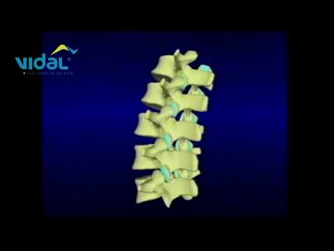 Inclinação Lateral Lombar – Vidal