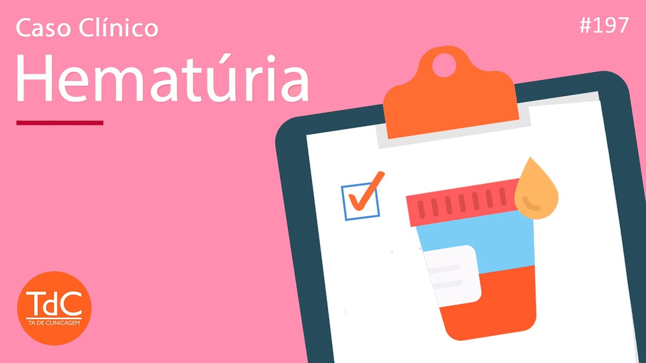 Hematúria: Como abordar? Episódio 197