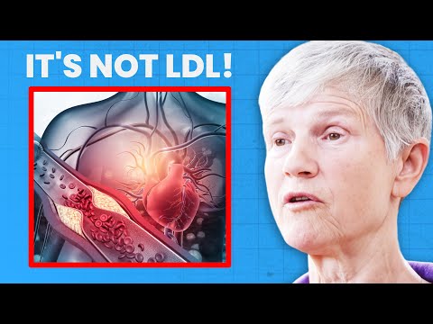The REAL Drivers of Heart Disease (Not High Cholesterol) | Dr. Sarah Myhill