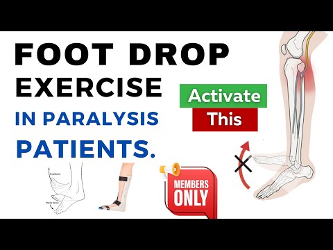 UPPER LIMB TRAINING SCAPULA ACTIVATION EXERCISE POST STROKE PHYSIOTHERAPY REHABILITATION
