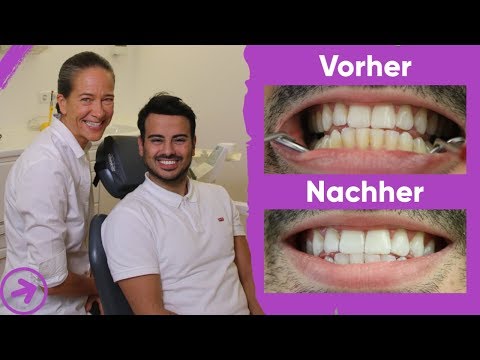 Bleaching live Behandlung bei Dr. Andrea Jacob | Zahnaufhellung beim Zahnarzt | Meine Erfahrung