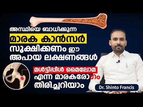 അസ്ഥിയെ ബാധിക്കുന്ന മാരക കാൻസർ സൂക്ഷിക്കണം ഈ അപായ ലക്ഷണങ്ങൾ | Multiple Myeloma | Dr Shinto Francis