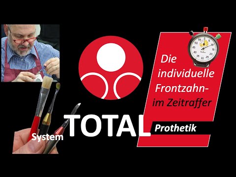 Die Frontzahn-Modellation im Zeitraffer - Teil 3     #KallemachtProthesen