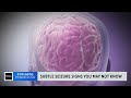 What Are The Symptoms And Signs Of A Seizure