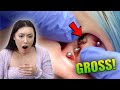 Her Piercing Was Filled With Pus!! *Gross*