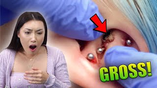 Her Piercing Was Filled With Pus!! *Gross*