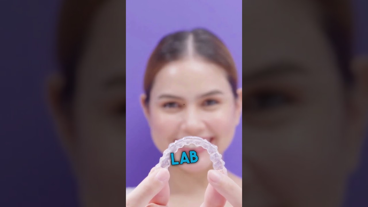 Are braces more expensive than Invisalign? Tipseri