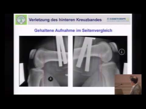 Ursachen für Hüfterkrankung Schmerzende Gelenke und Lendentemperatur