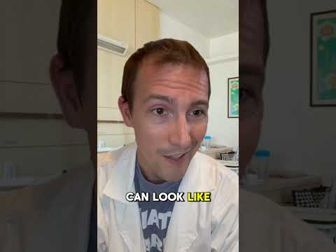 The dangers of delirium