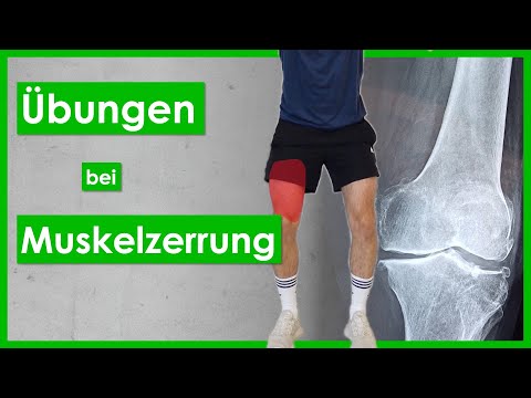 Thigh strain🦵Tear of the front of the thigh⎮Quadriceps injury⎮Rehab