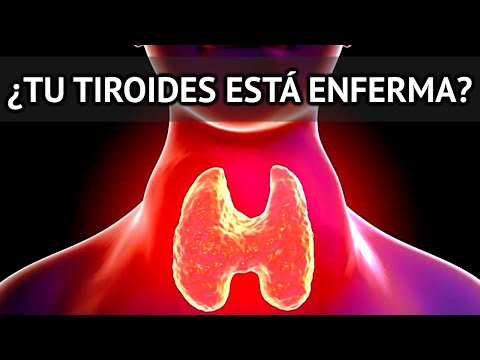 10 SIGNS AND SYMPTOMS of HYPOTHYROIDISM that you should never IGNORE