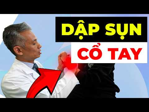 DẬP SỤN CỔ TAY SAU NGÃ XE: Sai lầm khiến bạn đau mãi không khỏi