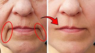 Take THIS to remove mouth wrinkles 💥 (Incredibly fast) 🤯