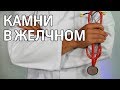 Хороший врач. Камни в желчном пузыре Хороший врач. Камни в желчном пузыре