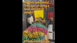 Nobody talks about THIS part of losing a large amount of weight… #obesity #Nike #ImWaitingforNike